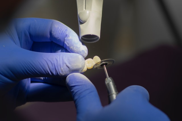 Jak dbać o implanty zębów?