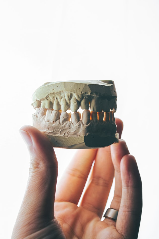 Jak się wstawia implanty zębów?