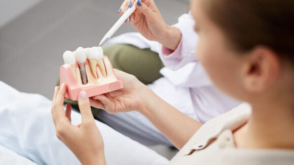 Kiedy stosujemy implanty zębów?