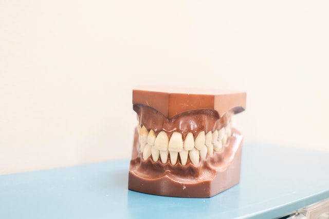 Implanty zębów na jak długo?