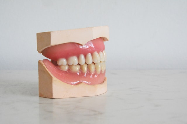 Kiedy implant zęba?