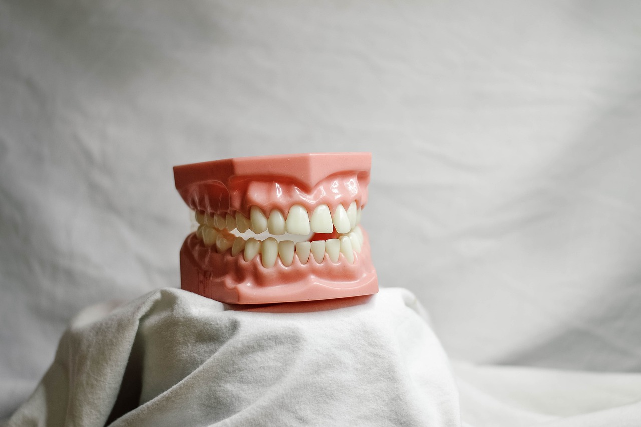 Kiedy można zrobić implant zęba?