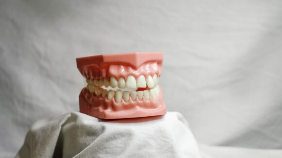 Kiedy po wyrwaniu zęba można wstawić implant?