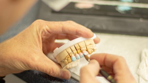 Na jak długo wystarczy implant zęba?