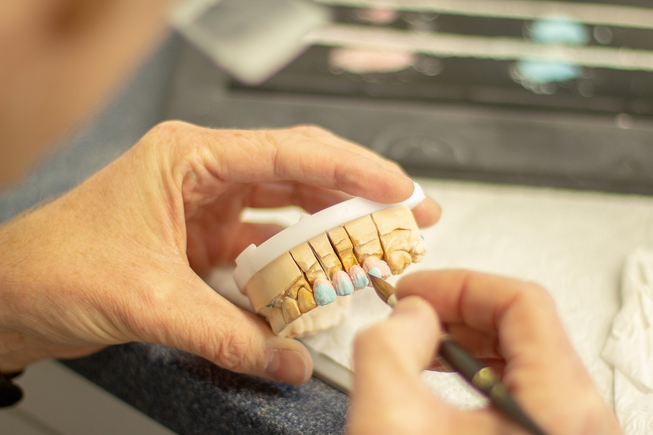 Na jak długo wystarczy implant zęba?