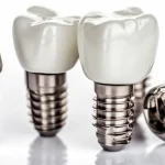 Czy implanty zębowe są bezpieczne dla zdrowia